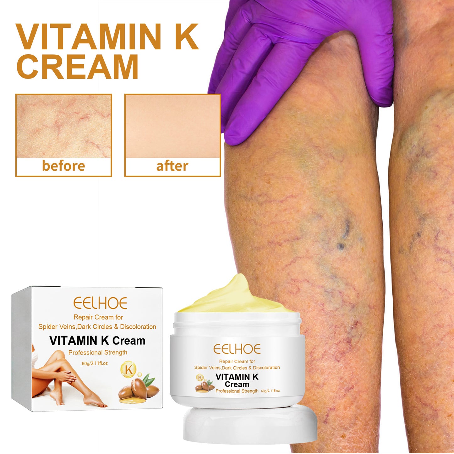 EELHOE Vitamin K Cream